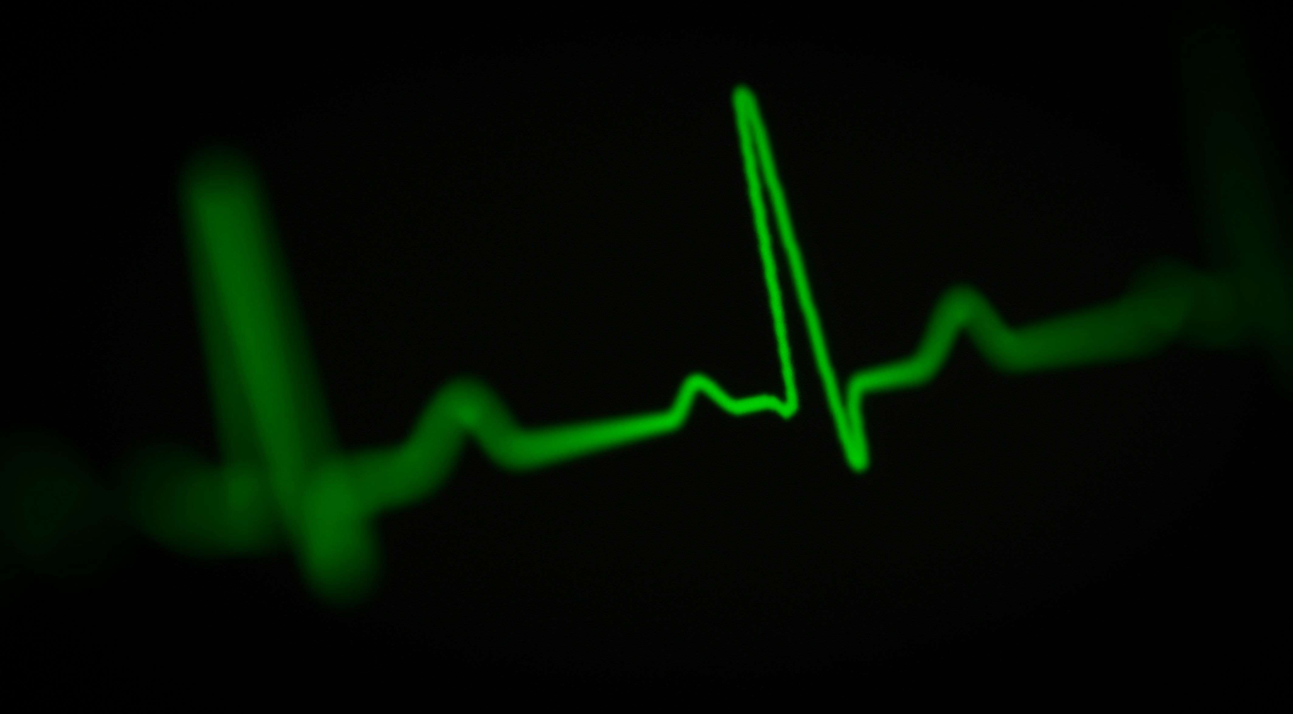 A heart rate monitor EKG display showing a continuous cardiac waveform, representing how beta-blockers change the signal your smart ring reads