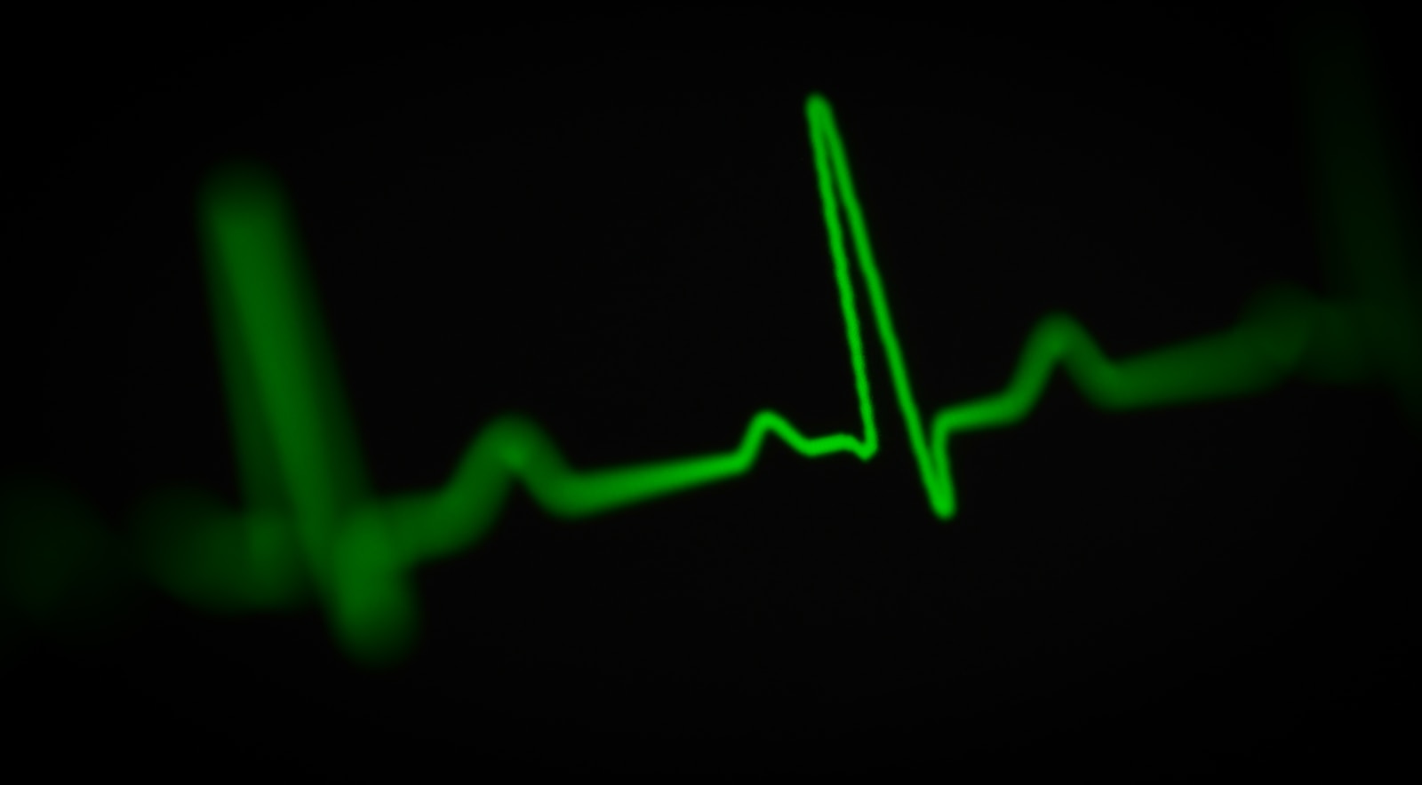 A heart rate monitor screen showing pulse data and cardiac rhythm, representing the direct cardiovascular effects of GLP-1 medications on resting heart rate