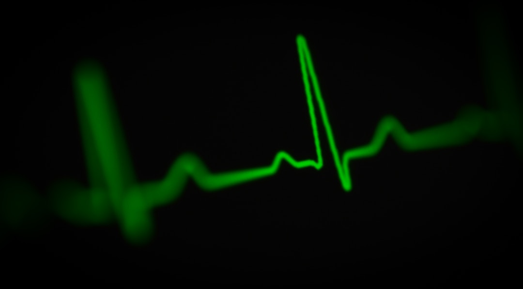 An ECG waveform diagram showing the difference between normal sinus rhythm and the chaotic irregular pattern of atrial fibrillation, illustrating what smart rings try to detect with PPG sensors